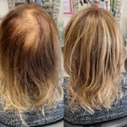 Avant après volumateur pour cheveux clairsemés femme réalisé au salon Ondu’line dans l’Yonne